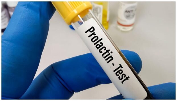 Prolactin Test : Early Detection for Hormonal Imbalance