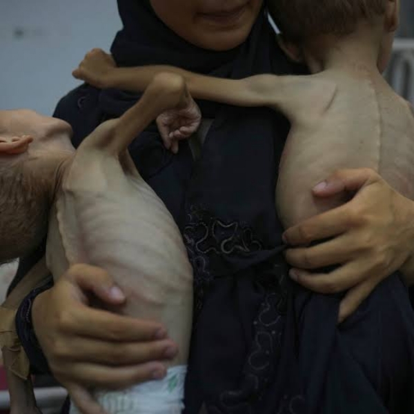 First Critically Ill Palestinian Children Evacuated from Gaza to UK for NHS Treatment